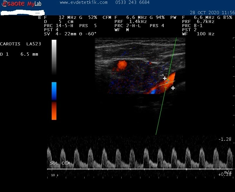 evde renkli doppler hizmeti